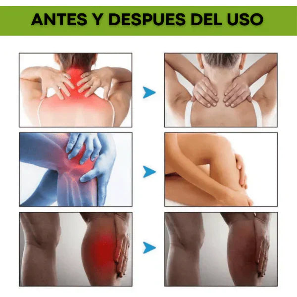 2x1 Beevana - Crema De veneno de abeja + Envio gratis a todo Guatemala